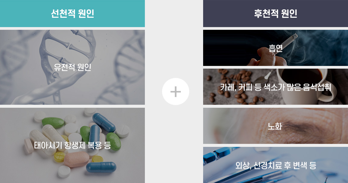선천적 원인(유전적 원인, 태아시기 항생제 복용 등) + 후천적 원인(흡연 + 카레, 커피 등 색소가 많은 음식 섭취 + 노화 + 외상, 신경치료 후 변색 등)